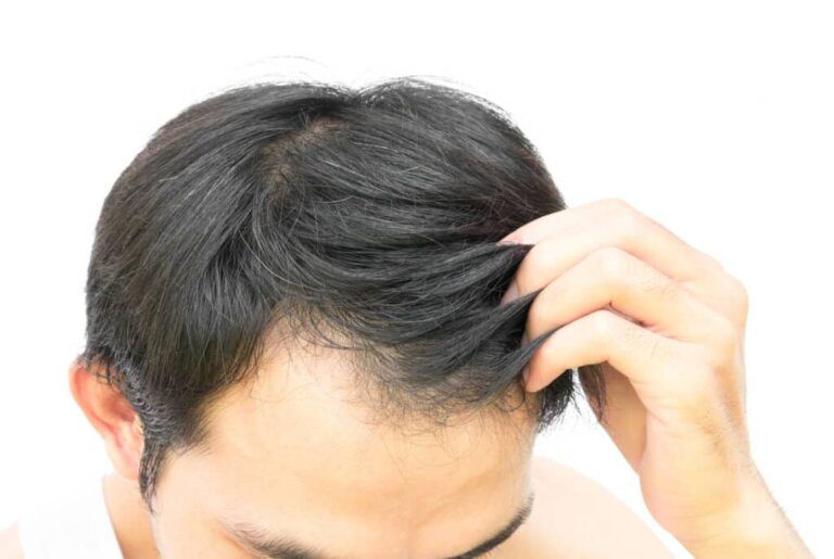 עיסוי ראש יכול גם לעזור להפחית מתח ומתחים, אשר עשויים לתרום לנשירת שיער.