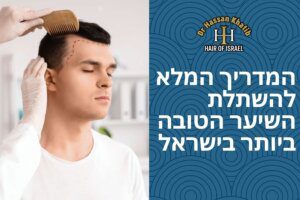 המדריך המלא להשתלת השיער הטובה ביותר בישראל
