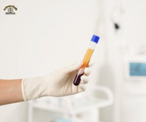 טיפול בפלזמה עשירה בטסיות